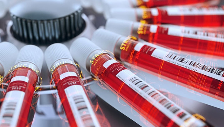 Toepassing van centrifugatie in de farmaceutische industrie